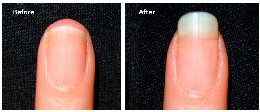 more keratin for hair and nails with MSM