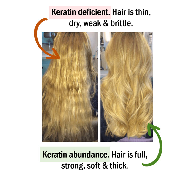 Abundant MSM leads to better keratin / hair follicle production