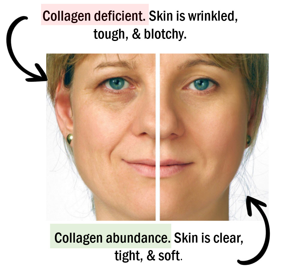 Low MSM / Sulfur also optimized collagen production