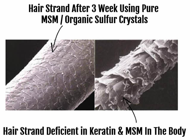 MSM supports hair follicles
