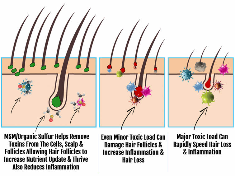 MSM and How It Protects Hair from toxicity and inflammation
