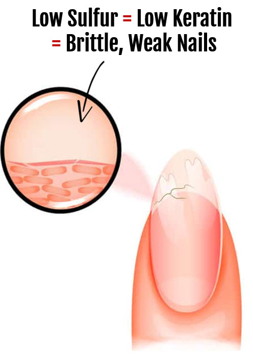 Low Keratin Does Not Only affect Hair it affects nails too